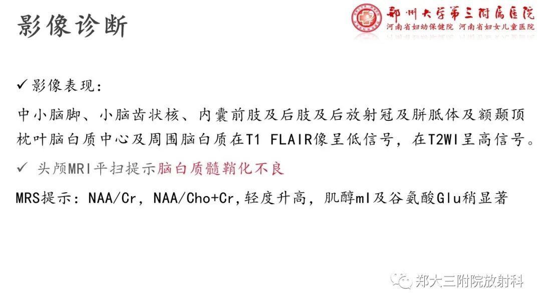 影像PPT - 【PPT】佩梅病的影像诊断-8