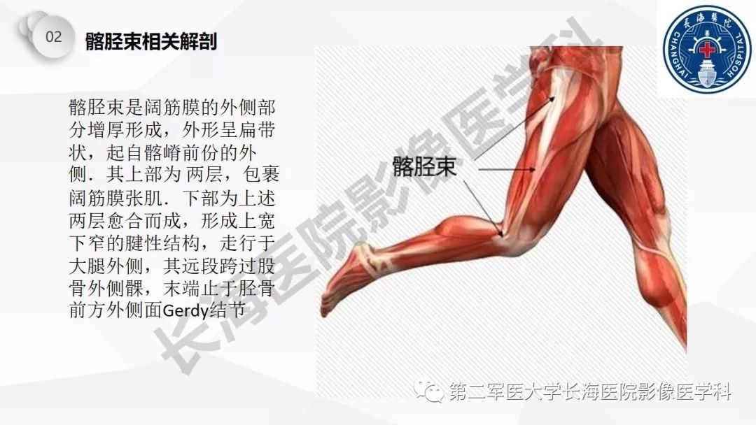 影像PPT - 【PPT】髂胫束摩擦综合症/髂胫束综合症-10