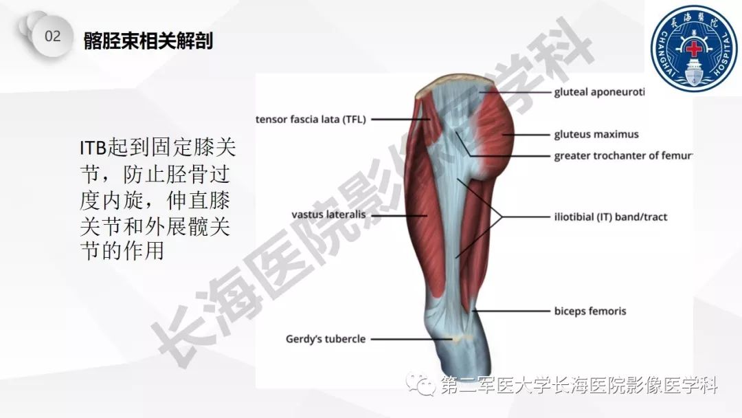影像PPT - 【PPT】髂胫束摩擦综合症/髂胫束综合症-11