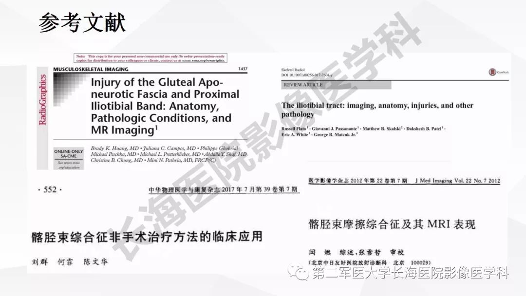 影像PPT - 【PPT】髂胫束摩擦综合症/髂胫束综合症-56