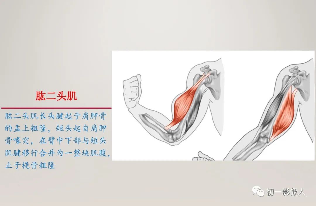 影像PPT - 【PPT】上臂大力水手征—肱二头肌长头腱断裂-2