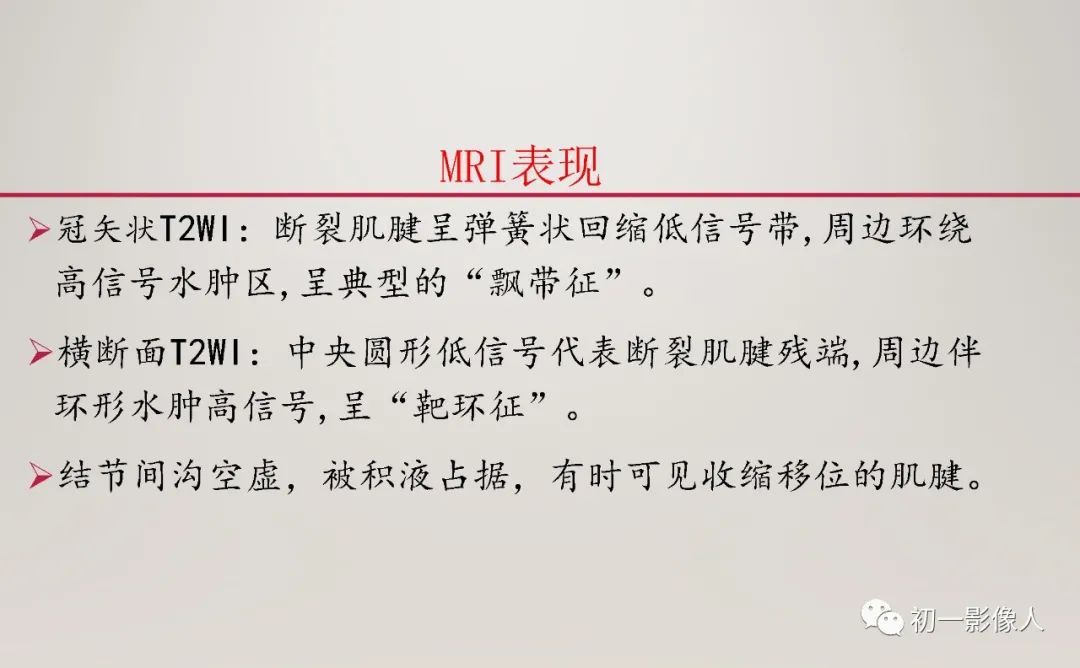 影像PPT - 【PPT】上臂大力水手征—肱二头肌长头腱断裂-4