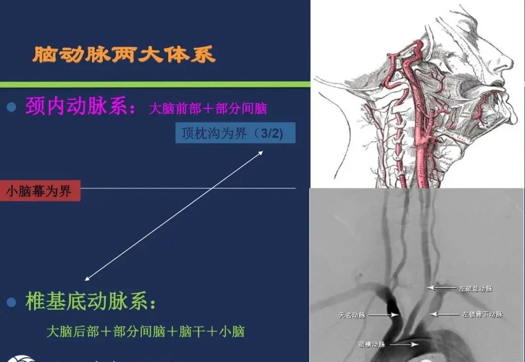 影像PPT - 从梗死部位推测责任血管:脑血管解剖-2 影像PPT - 从梗死部位推测责任血管:脑血管解剖-2