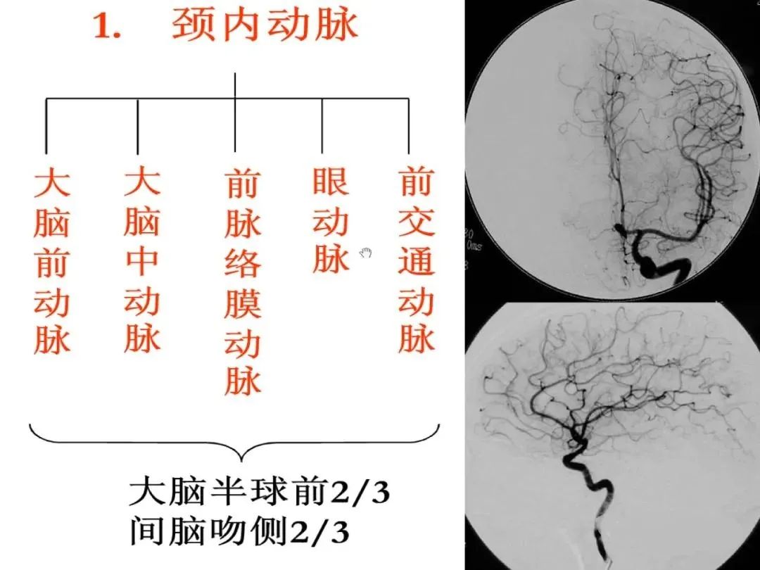 影像PPT - 从梗死部位推测责任血管:脑血管解剖-3 影像PPT - 从梗死部位推测责任血管:脑血管解剖-3