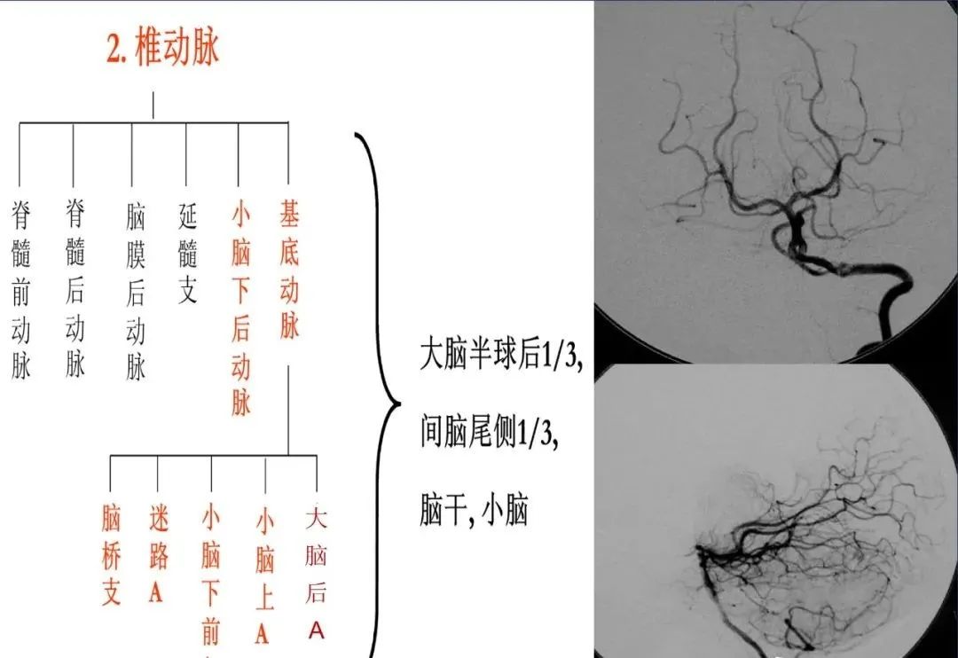 影像PPT - 从梗死部位推测责任血管:脑血管解剖-4 影像PPT - 从梗死部位推测责任血管:脑血管解剖-4