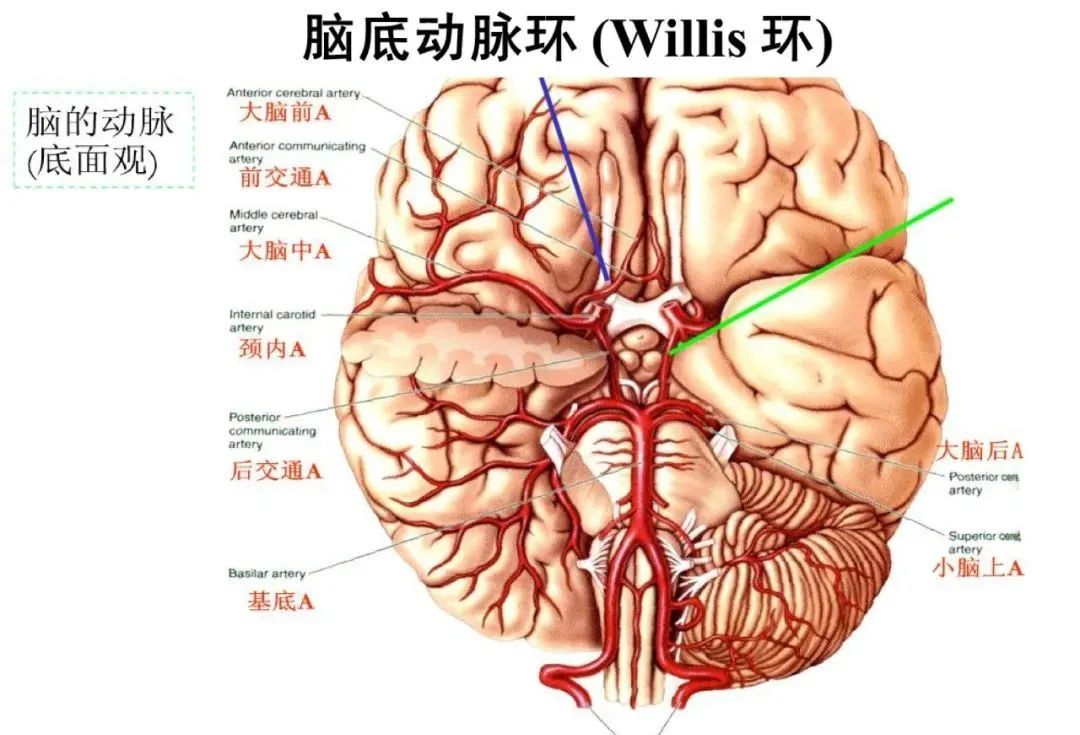 影像PPT - 从梗死部位推测责任血管:脑血管解剖-6 影像PPT - 从梗死部位推测责任血管:脑血管解剖-6