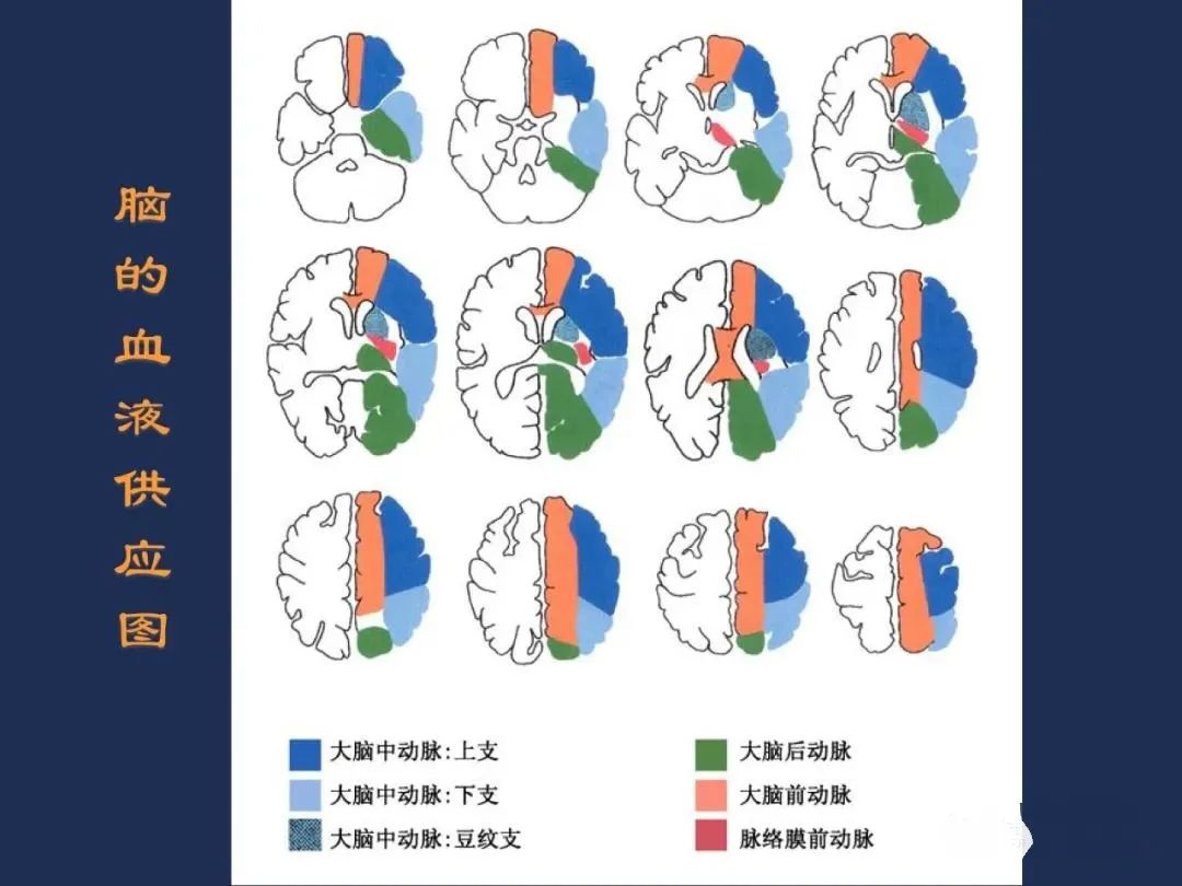 影像PPT - 从梗死部位推测责任血管:脑血管解剖-8 影像PPT - 从梗死部位推测责任血管:脑血管解剖-8