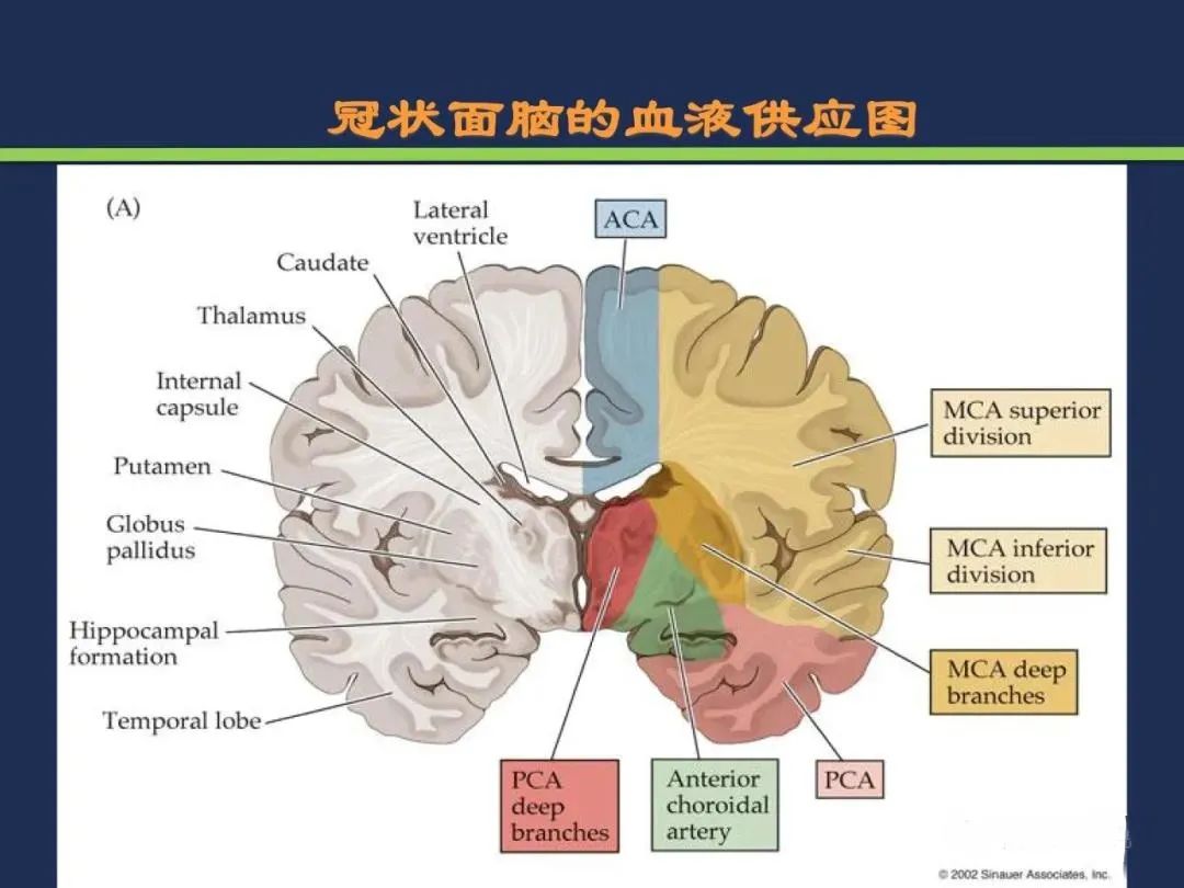 影像PPT - 从梗死部位推测责任血管:脑血管解剖-9 影像PPT - 从梗死部位推测责任血管:脑血管解剖-9