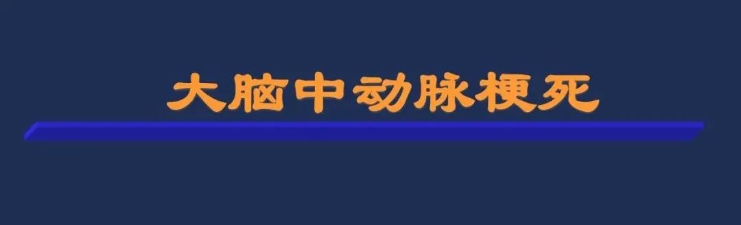 影像PPT - 从梗死部位推测责任血管:脑血管解剖-31 影像PPT - 从梗死部位推测责任血管:脑血管解剖-31