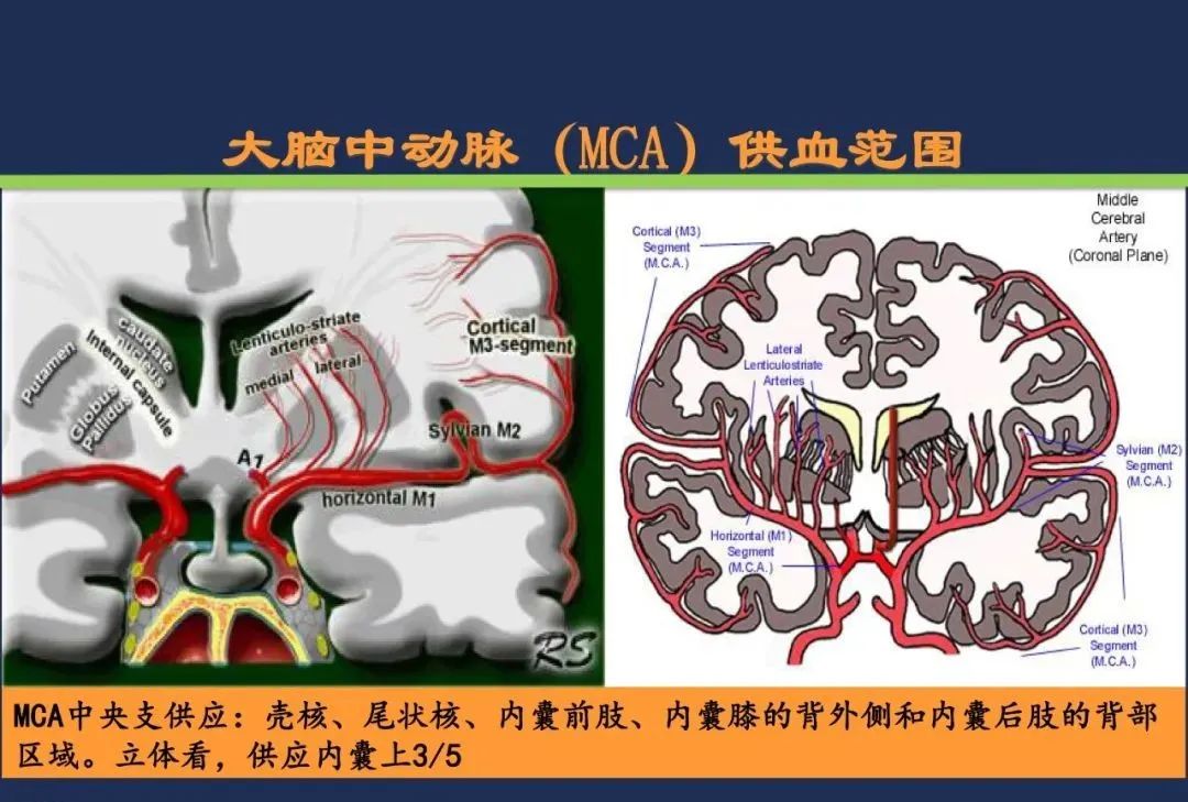 影像PPT - 从梗死部位推测责任血管:脑血管解剖-33 影像PPT - 从梗死部位推测责任血管:脑血管解剖-33