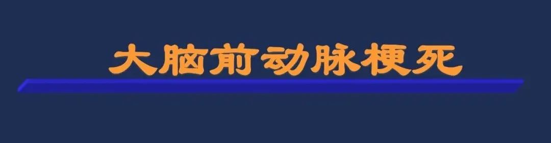 影像PPT - 从梗死部位推测责任血管:脑血管解剖-54 影像PPT - 从梗死部位推测责任血管:脑血管解剖-54