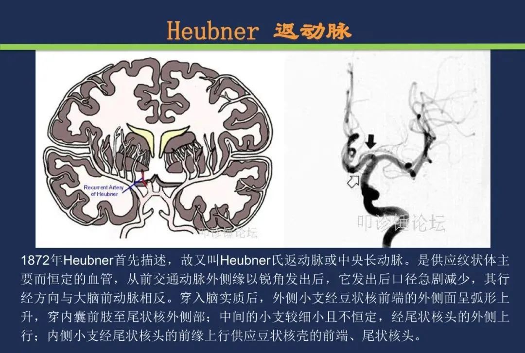 影像PPT - 从梗死部位推测责任血管:脑血管解剖-66 影像PPT - 从梗死部位推测责任血管:脑血管解剖-66