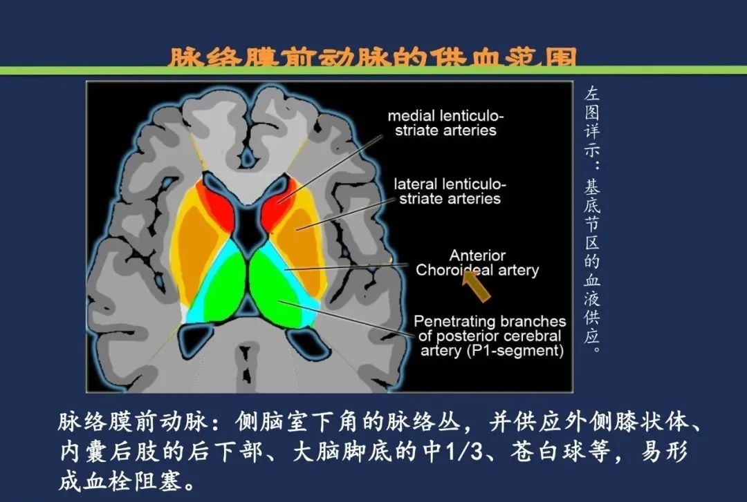 影像PPT - 从梗死部位推测责任血管:脑血管解剖-77 影像PPT - 从梗死部位推测责任血管:脑血管解剖-77