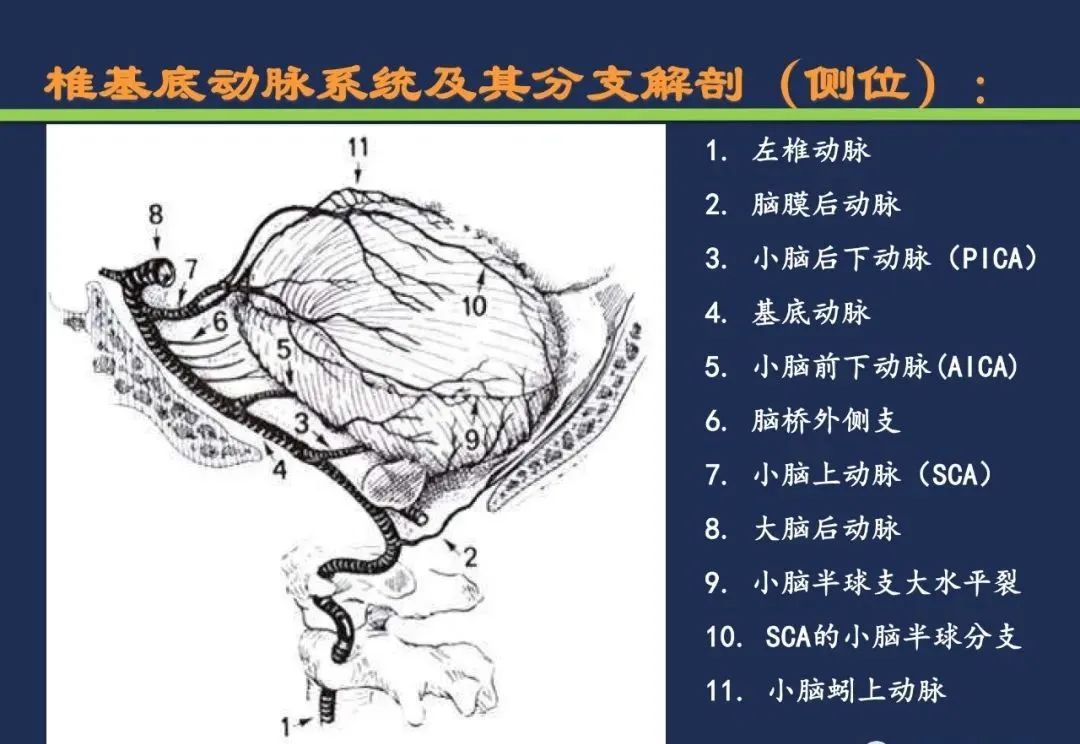 影像PPT - 从梗死部位推测责任血管:脑血管解剖-84 影像PPT - 从梗死部位推测责任血管:脑血管解剖-84