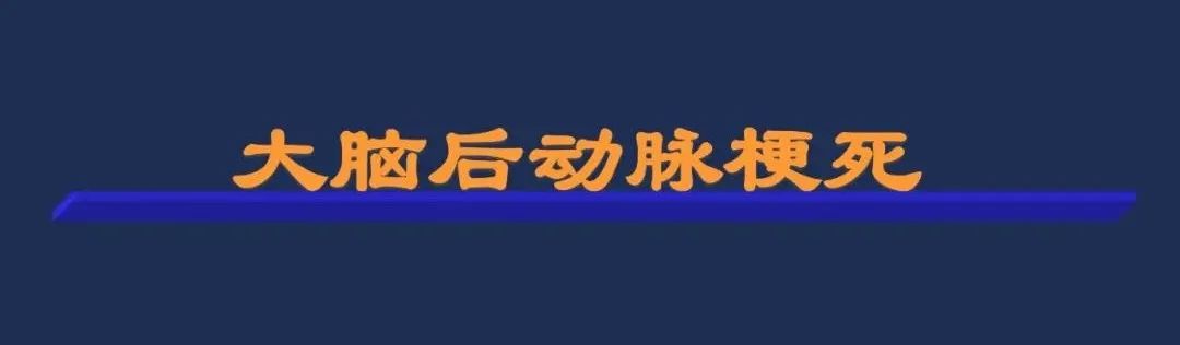 影像PPT - 从梗死部位推测责任血管:脑血管解剖-86 影像PPT - 从梗死部位推测责任血管:脑血管解剖-86