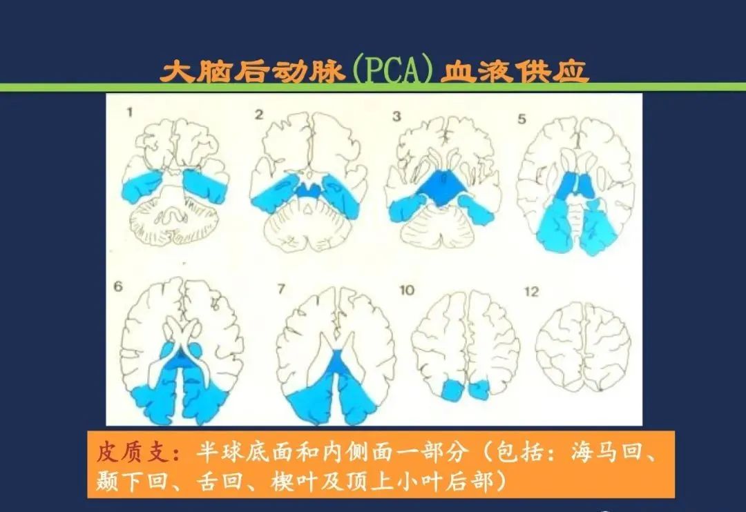 影像PPT - 从梗死部位推测责任血管:脑血管解剖-88 影像PPT - 从梗死部位推测责任血管:脑血管解剖-88