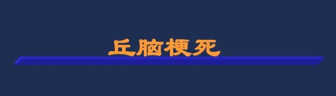 影像PPT - 从梗死部位推测责任血管:脑血管解剖-97 影像PPT - 从梗死部位推测责任血管:脑血管解剖-97