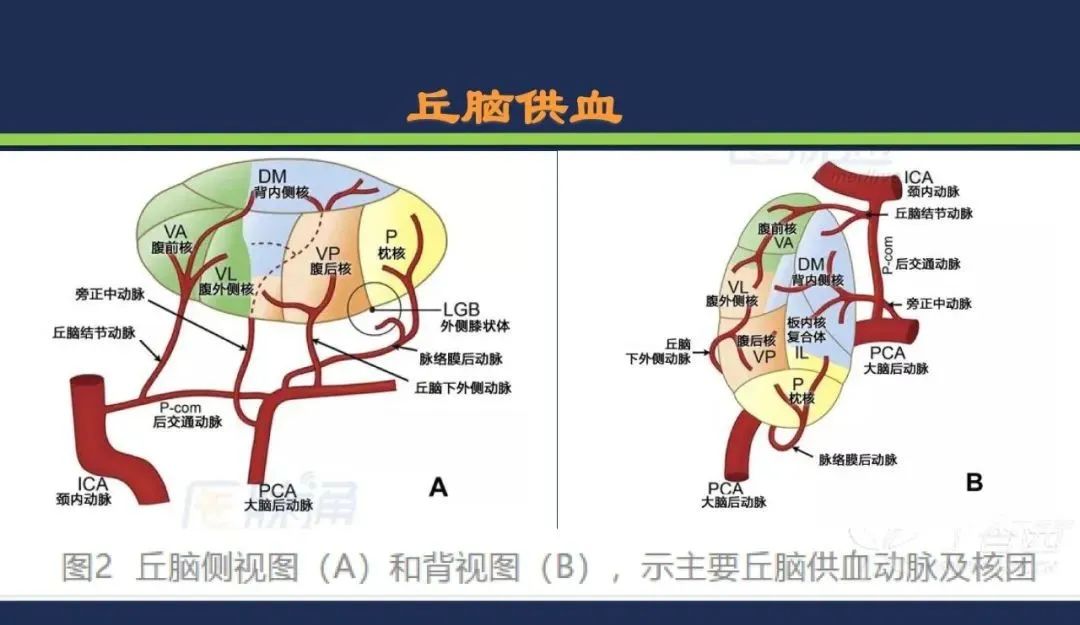 影像PPT - 从梗死部位推测责任血管:脑血管解剖-99 影像PPT - 从梗死部位推测责任血管:脑血管解剖-99