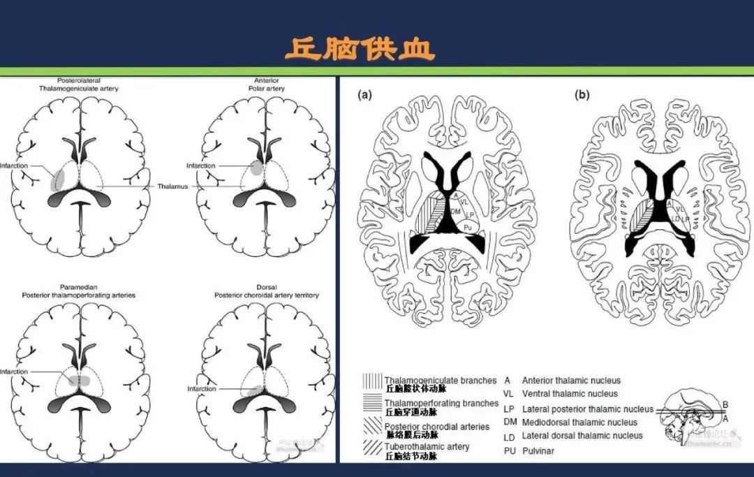 影像PPT - 从梗死部位推测责任血管:脑血管解剖-100 影像PPT - 从梗死部位推测责任血管:脑血管解剖-100