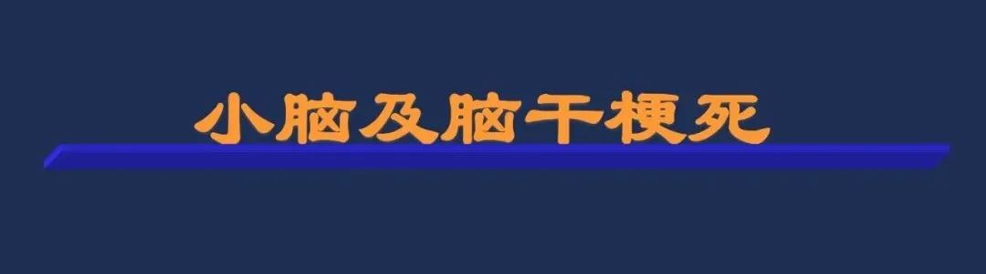 影像PPT - 从梗死部位推测责任血管:脑血管解剖-123 影像PPT - 从梗死部位推测责任血管:脑血管解剖-123