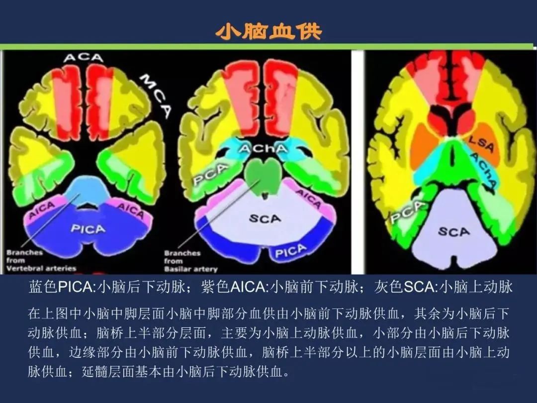 影像PPT - 从梗死部位推测责任血管:脑血管解剖-125 影像PPT - 从梗死部位推测责任血管:脑血管解剖-125