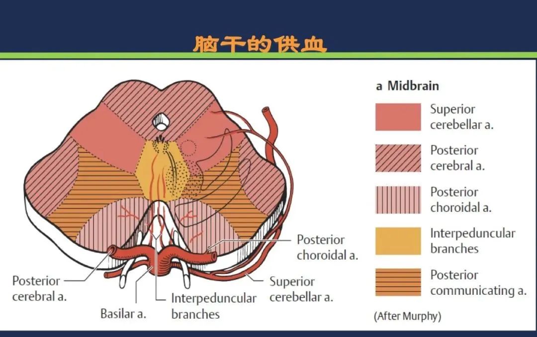 影像PPT - 从梗死部位推测责任血管:脑血管解剖-129 影像PPT - 从梗死部位推测责任血管:脑血管解剖-129