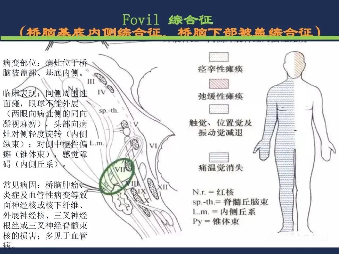 影像PPT - 从梗死部位推测责任血管:脑血管解剖-132 影像PPT - 从梗死部位推测责任血管:脑血管解剖-132