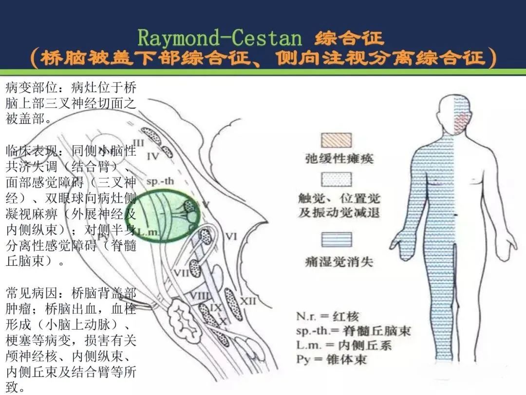 影像PPT - 从梗死部位推测责任血管:脑血管解剖-142 影像PPT - 从梗死部位推测责任血管:脑血管解剖-142