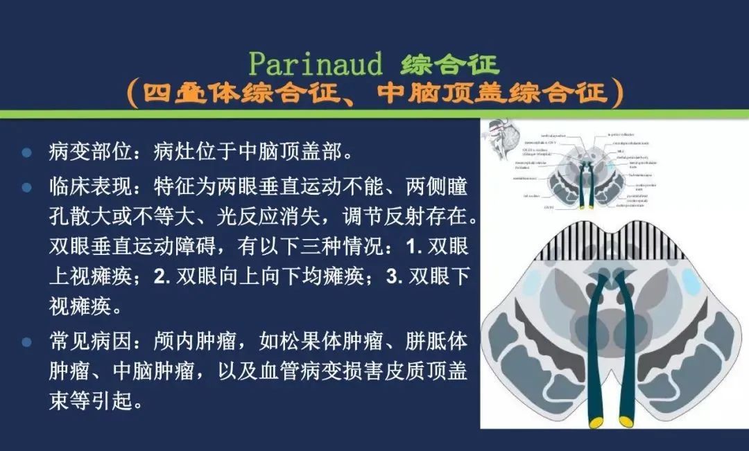 影像PPT - 从梗死部位推测责任血管:脑血管解剖-148 影像PPT - 从梗死部位推测责任血管:脑血管解剖-148
