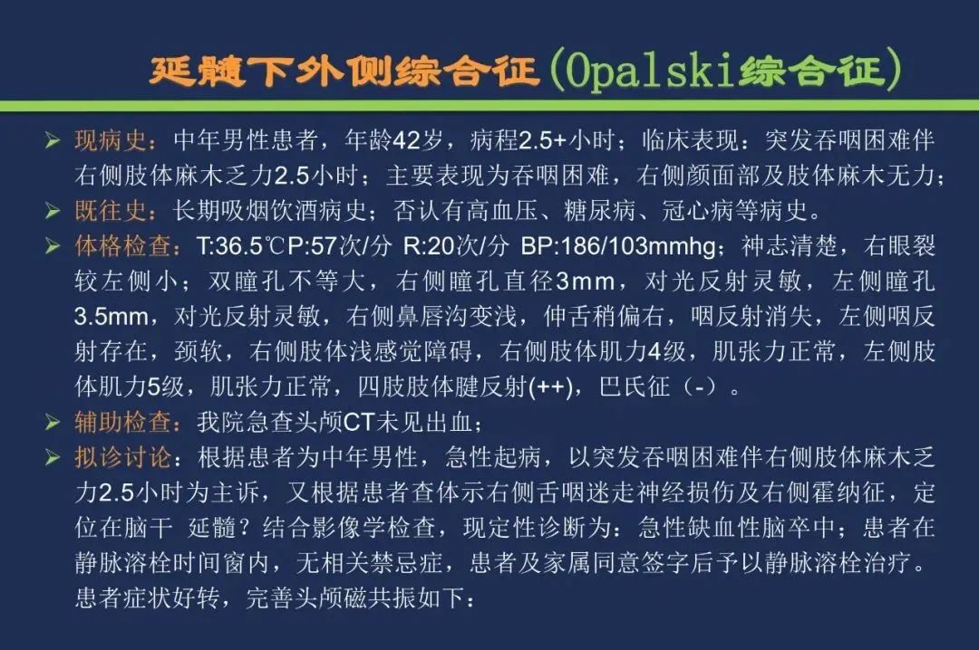影像PPT - 从梗死部位推测责任血管:脑血管解剖-178 影像PPT - 从梗死部位推测责任血管:脑血管解剖-178