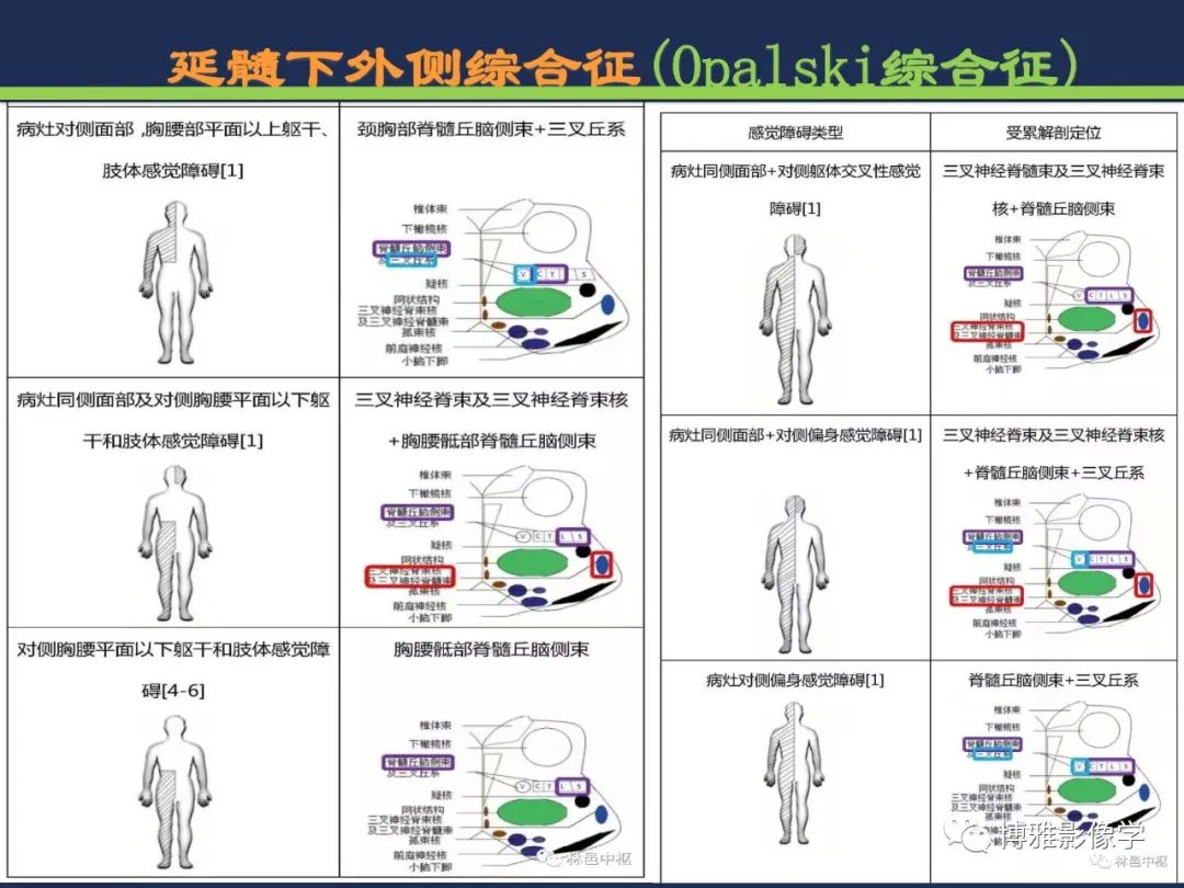 影像PPT - 从梗死部位推测责任血管:脑血管解剖-180 影像PPT - 从梗死部位推测责任血管:脑血管解剖-180