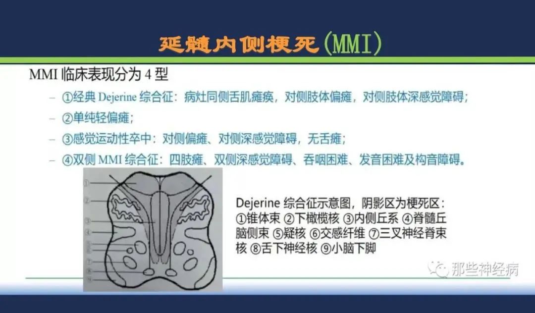 影像PPT - 从梗死部位推测责任血管:脑血管解剖-185 影像PPT - 从梗死部位推测责任血管:脑血管解剖-185