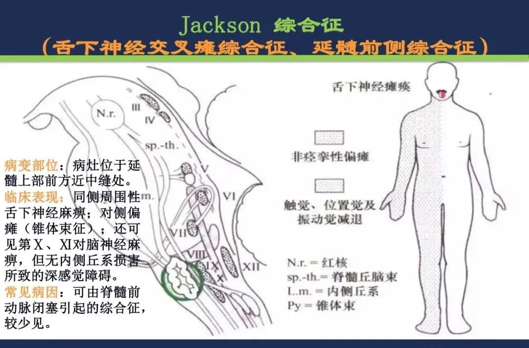 影像PPT - 从梗死部位推测责任血管:脑血管解剖-189 影像PPT - 从梗死部位推测责任血管:脑血管解剖-189