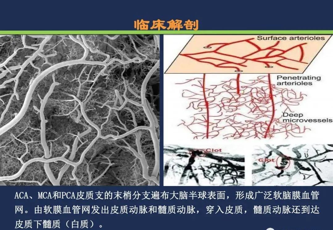 影像PPT - 从梗死部位推测责任血管:脑血管解剖-217 影像PPT - 从梗死部位推测责任血管:脑血管解剖-217