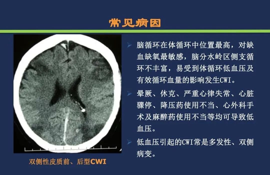 影像PPT - 从梗死部位推测责任血管:脑血管解剖-220 影像PPT - 从梗死部位推测责任血管:脑血管解剖-220