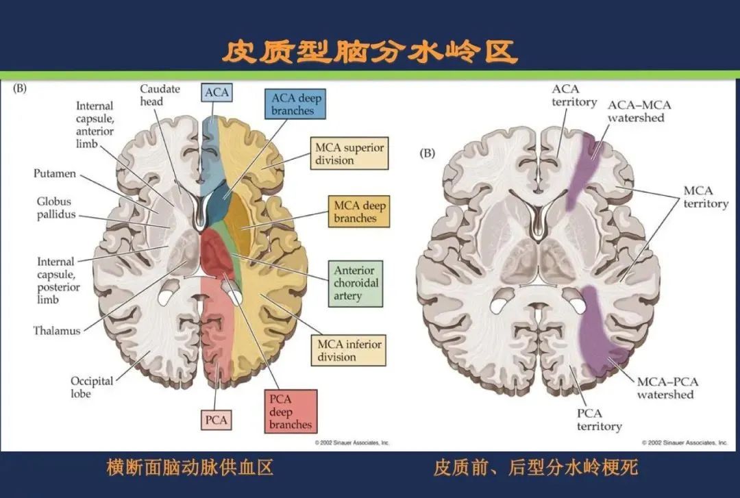 影像PPT - 从梗死部位推测责任血管:脑血管解剖-239 影像PPT - 从梗死部位推测责任血管:脑血管解剖-239
