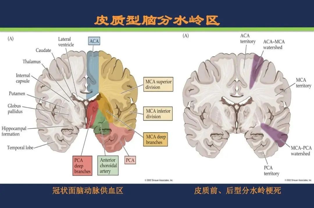 影像PPT - 从梗死部位推测责任血管:脑血管解剖-240 影像PPT - 从梗死部位推测责任血管:脑血管解剖-240