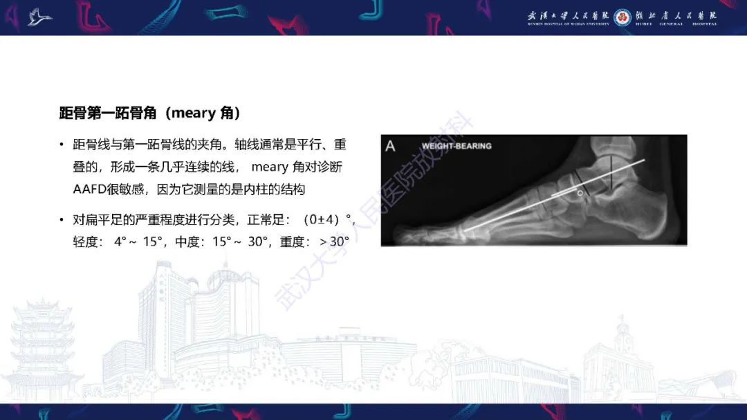 影像PPT - 【PPT】成人获得性扁平足畸形: 解剖学、生物力学、分期和影像学表现-9
