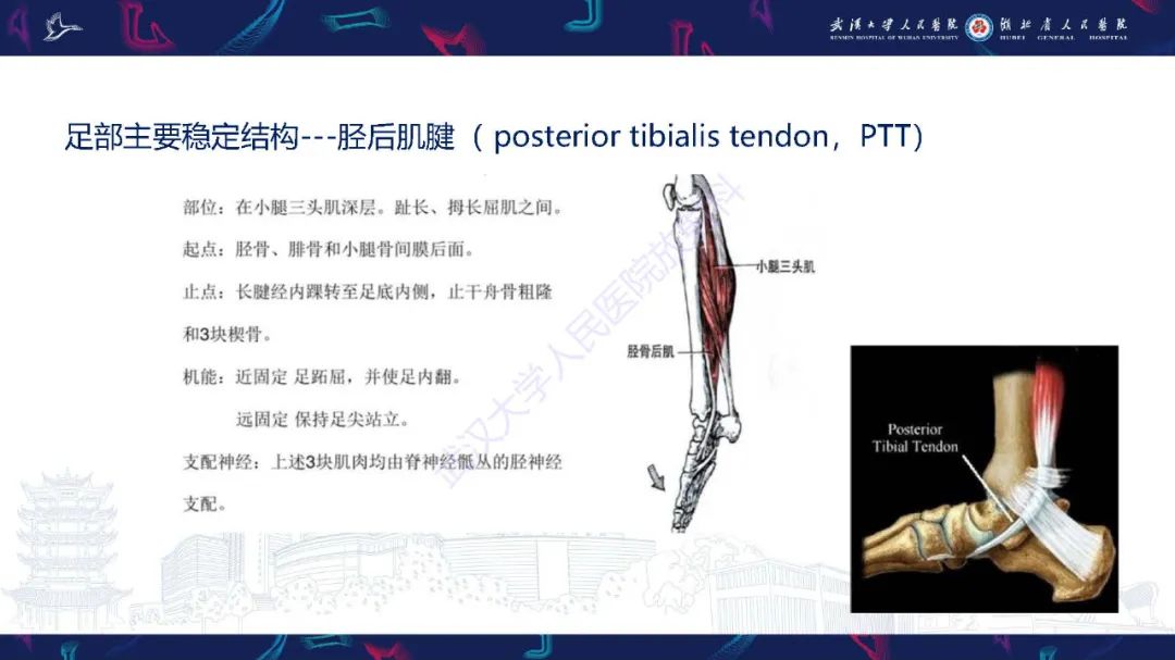 影像PPT - 【PPT】成人获得性扁平足畸形: 解剖学、生物力学、分期和影像学表现-15