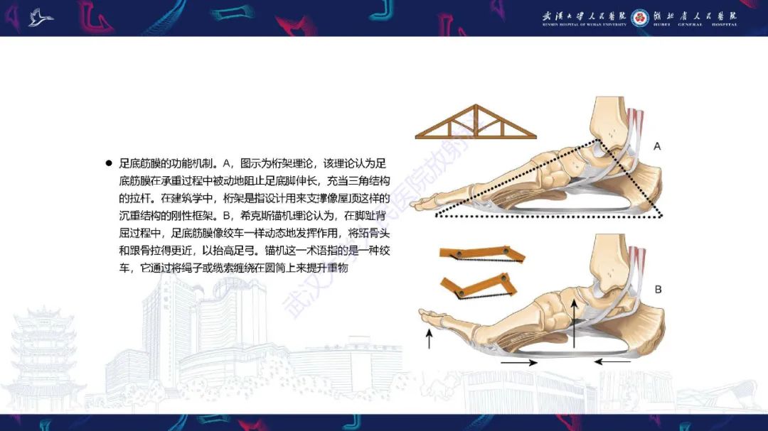 影像PPT - 【PPT】成人获得性扁平足畸形: 解剖学、生物力学、分期和影像学表现-34