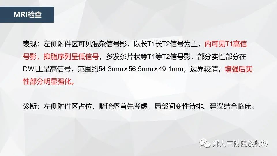 影像PPT - 【病例】卵巢畸胎瘤1例诊断思路-9