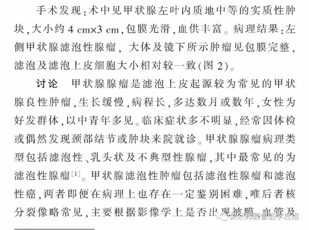 影像PPT - 【病例】甲状腺腺瘤1例影像诊断思维-5