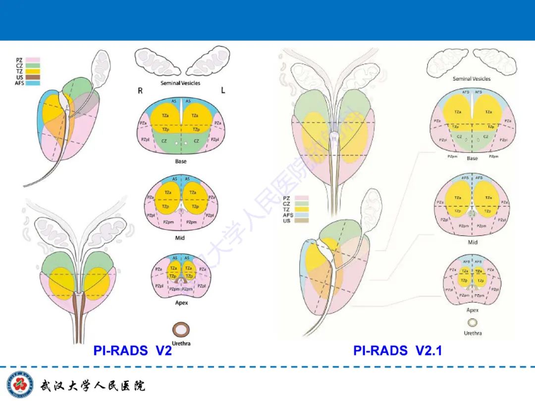 影像PPT - 【PPT】前列腺PI-RADS 2.1版本更新解读-7