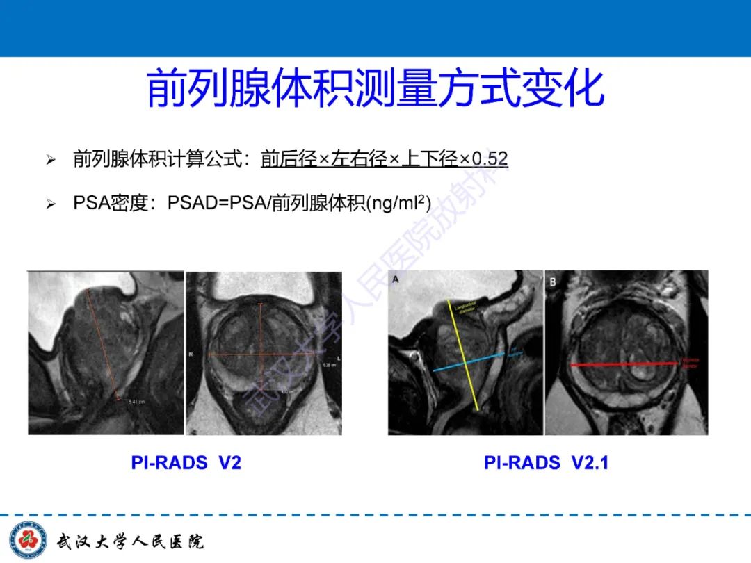 影像PPT - 【PPT】前列腺PI-RADS 2.1版本更新解读-9