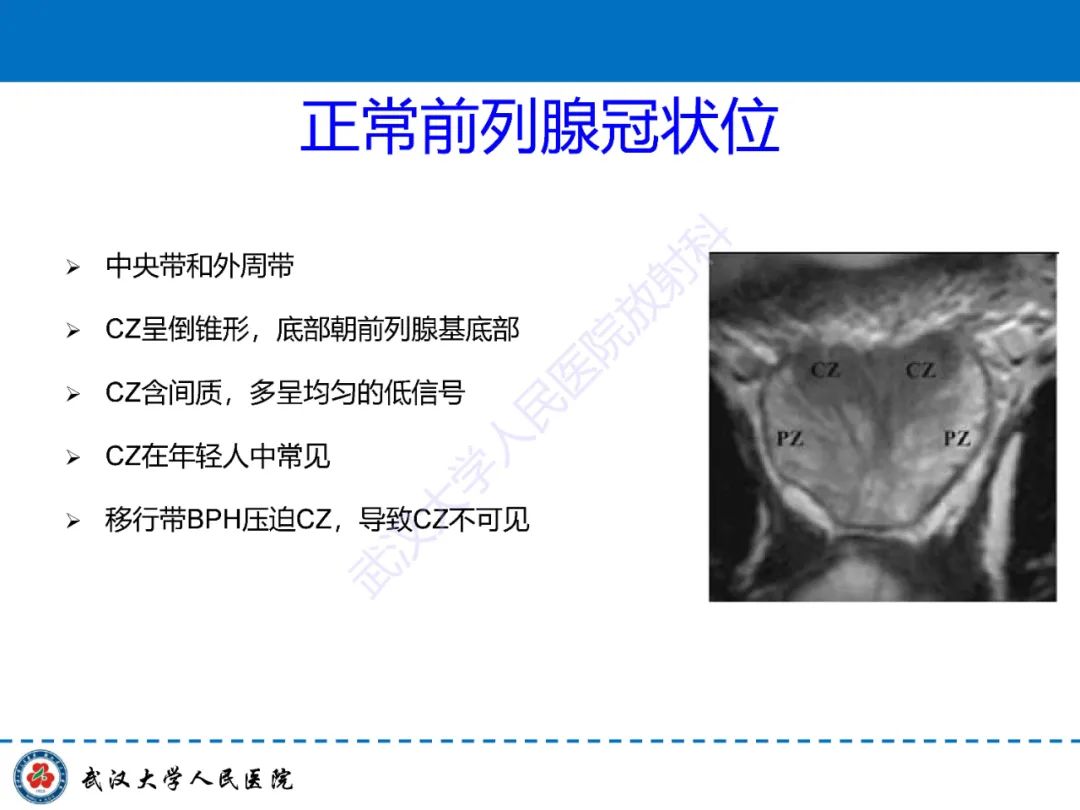 影像PPT - 【PPT】前列腺PI-RADS 2.1版本更新解读-11