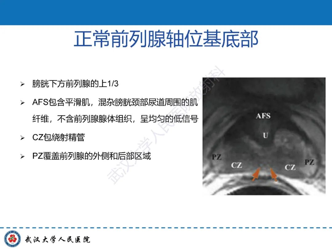 影像PPT - 【PPT】前列腺PI-RADS 2.1版本更新解读-12