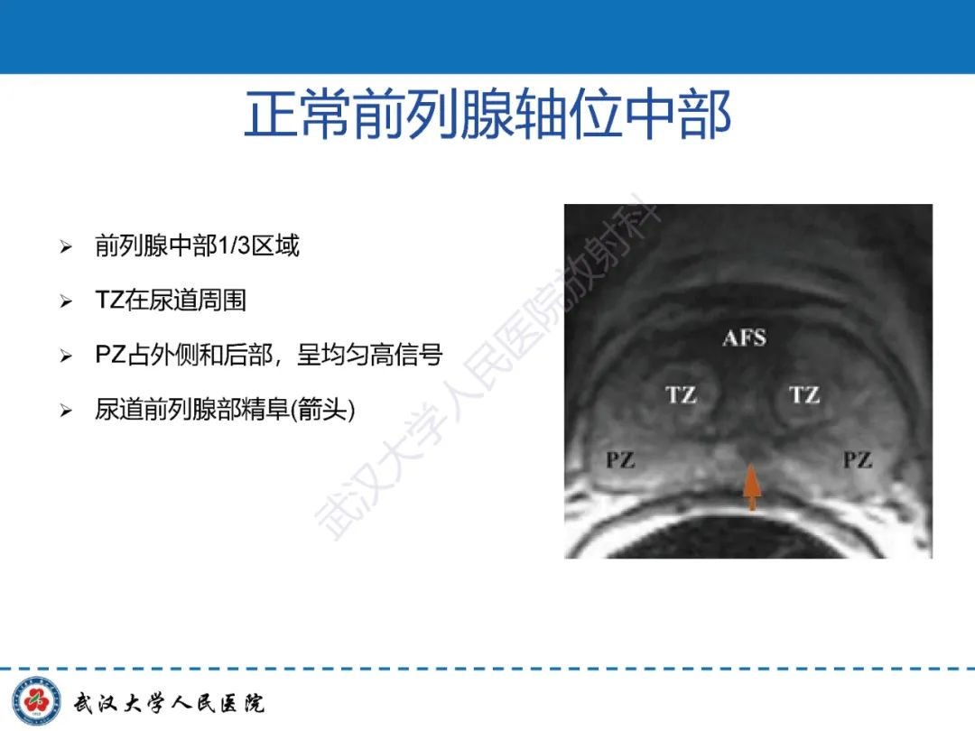 影像PPT - 【PPT】前列腺PI-RADS 2.1版本更新解读-13