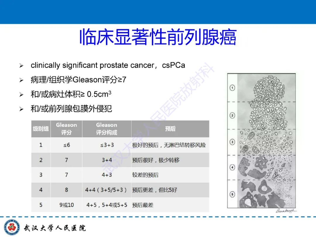 影像PPT - 【PPT】前列腺PI-RADS 2.1版本更新解读-19