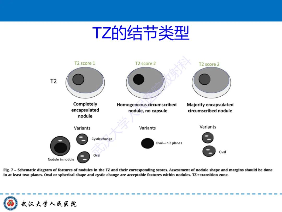 影像PPT - 【PPT】前列腺PI-RADS 2.1版本更新解读-29
