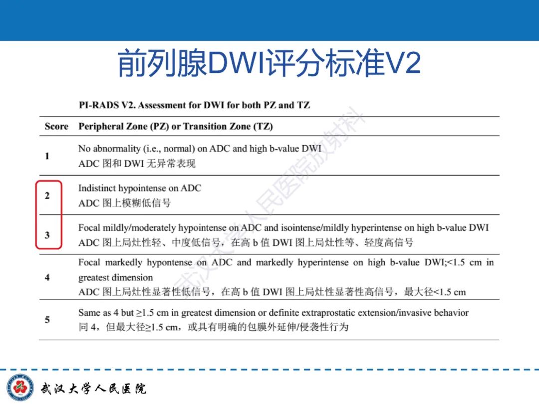 影像PPT - 【PPT】前列腺PI-RADS 2.1版本更新解读-34